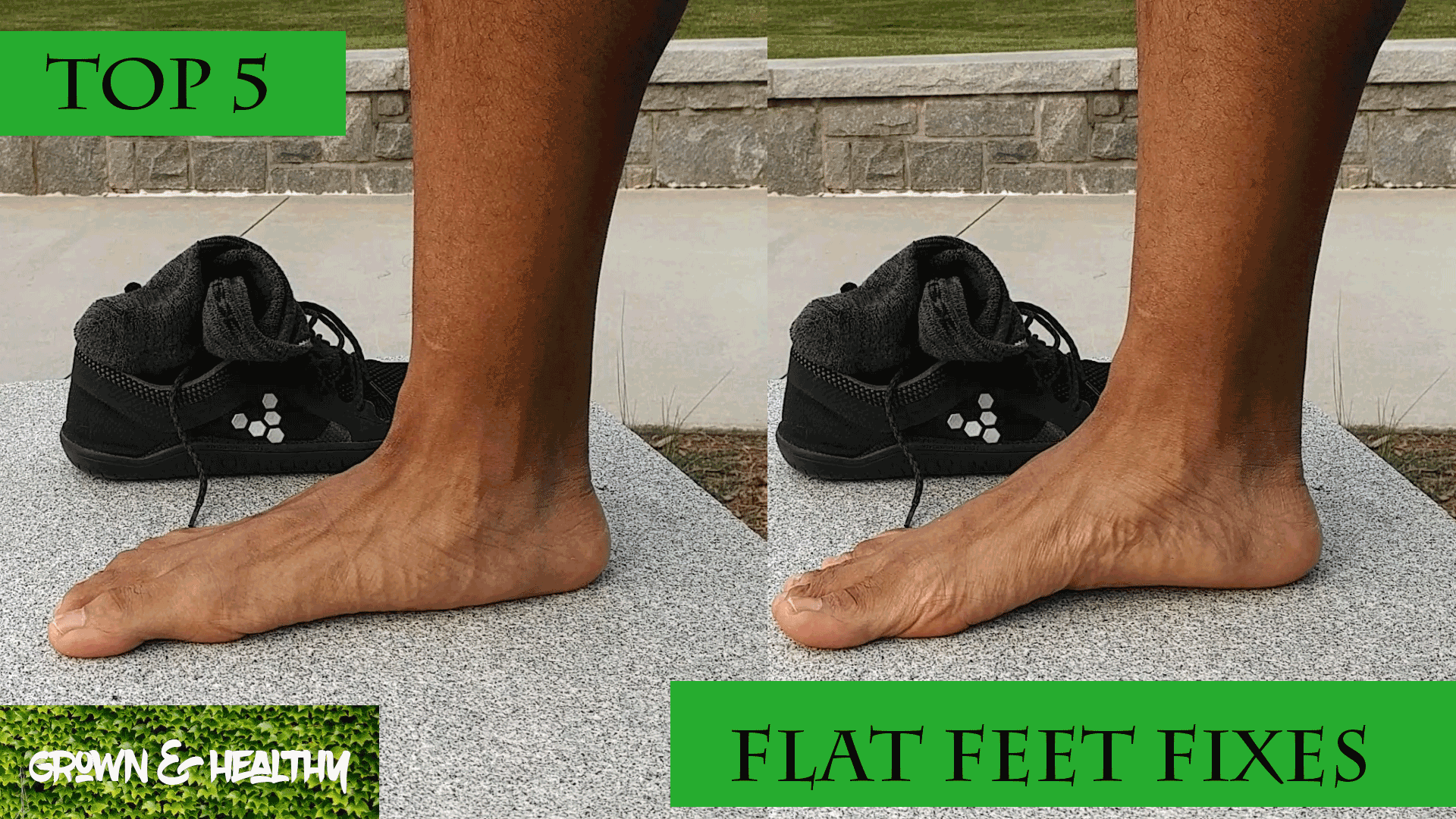 Top 5 Fixes For Flat Feet Grown Healthy